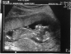scan1.PNG (61946 bytes)